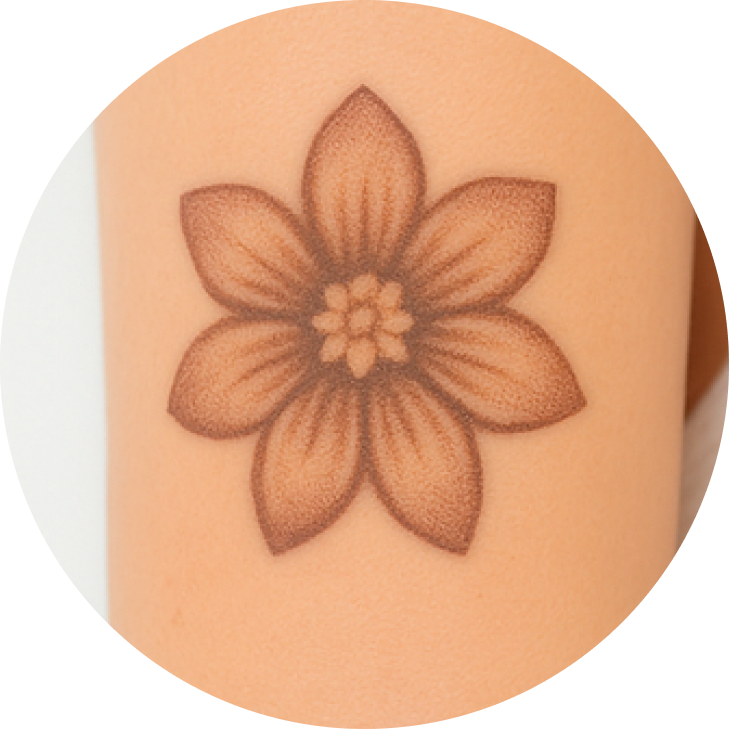 인공 색소 제거